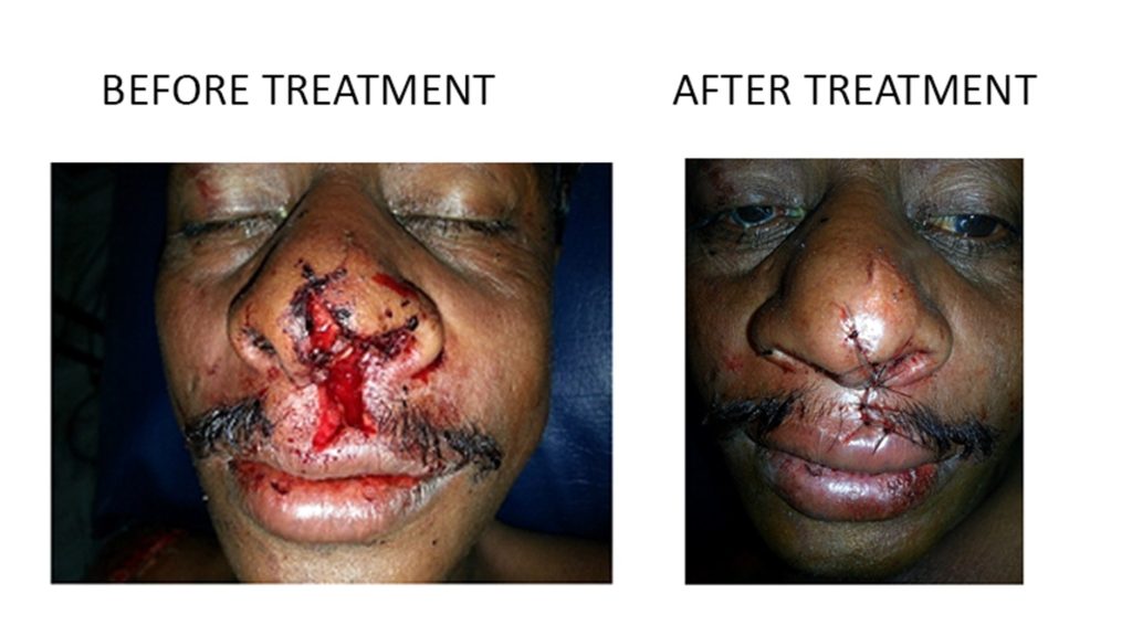 Read more about the article Facial Trauma