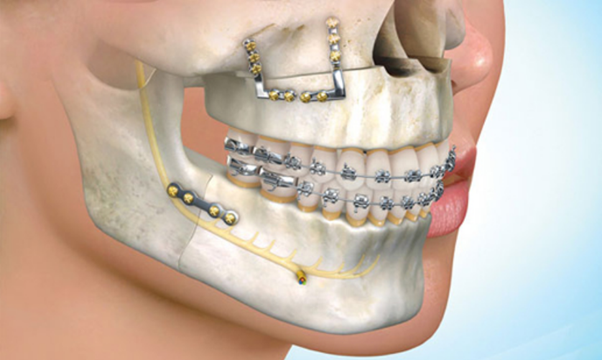Read more about the article Maxillofacial Surgery