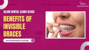 Read more about the article Benefits of Invisible Braces
