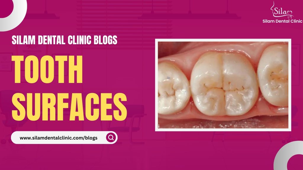 Read more about the article Tooth Surfaces